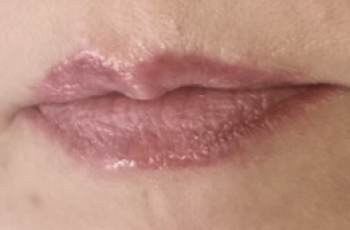Prečo mám po tetovaní obočie, pery flakaté ?